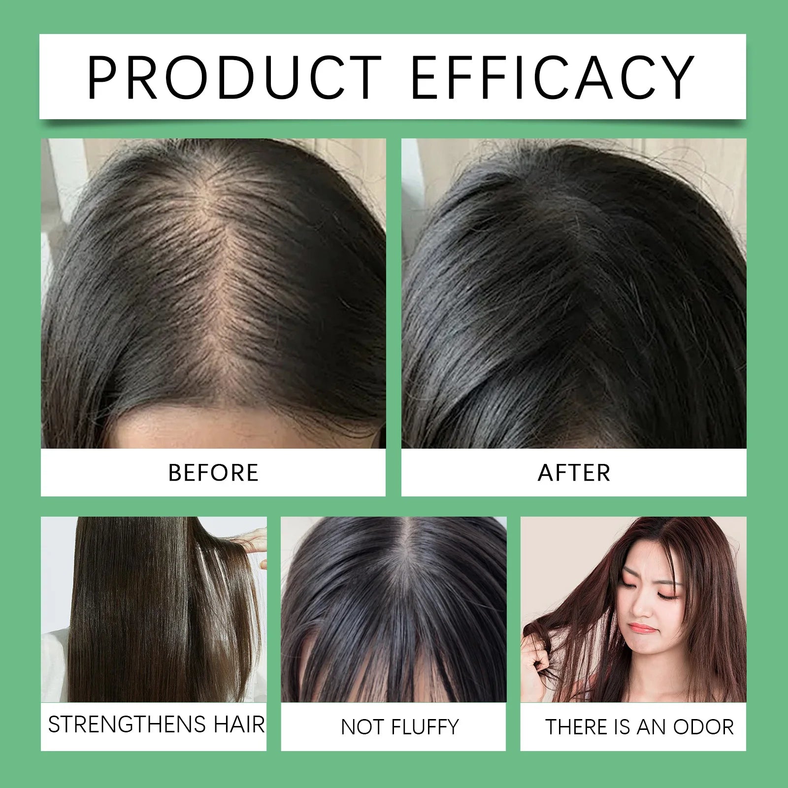 Batana & Rosemary Shampoo 100/300ml – Anti-Dandruff Nourishing Hair Care - All Things Beauty -